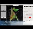 Real Time Fiber Tracking