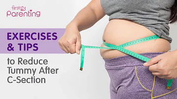 How can I reduce my tummy after c-section?