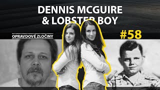 #58 - Dennis McGuire & Lobster Boy