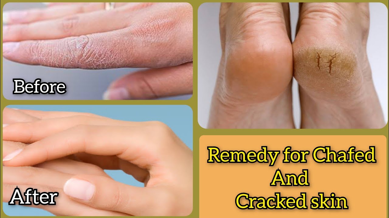 DIY Winter Whitening Cream for Dark complexion|cracked heels|Winter ...