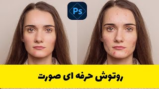 روتوش حرفه ای صورت|روتوش صورت با فتوشاپ