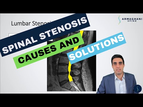 Video: Lumbosacral stenosis koirilla