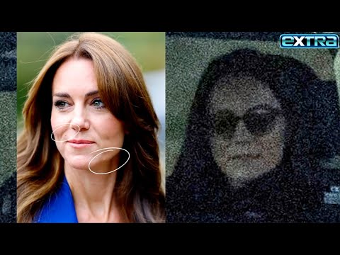 First Pic of Kate Middleton Post-Surgery Sparks CONSPIRACY Theories