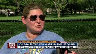 Child contracts measles in Pinellas County