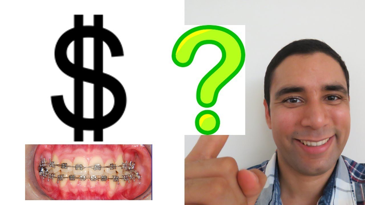 precio de ponerse brackets en ecuador