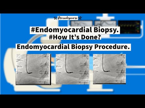 what is Endomyocardial Biopsy? How It&rsquo;s Done? Endomyocardial Biopsy Procedure ?