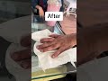 Hand rehabilitation #viral #youtube
