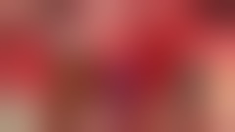 Sinus augmentation using HPISE and Ridge Augmentation