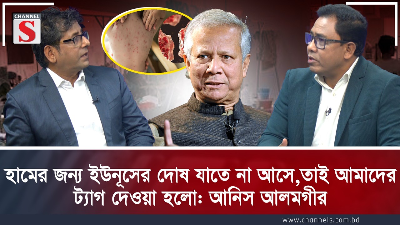 হামের জন্য ইউনূসের দোষ যাতে না আসে,তাই আমাদের ট্যাগ দেওয়া হলো: আনিস | Anis Alamgir | Channel S