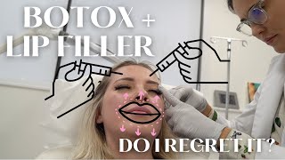lip filler + botox FIRST TIME experience... never again