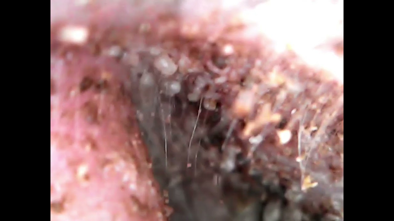 Ear mites in Kitten. YouTube