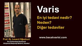 Varisin En İyi Tedavisi Ablasyon Yöntemleri Hakkında Her Şey