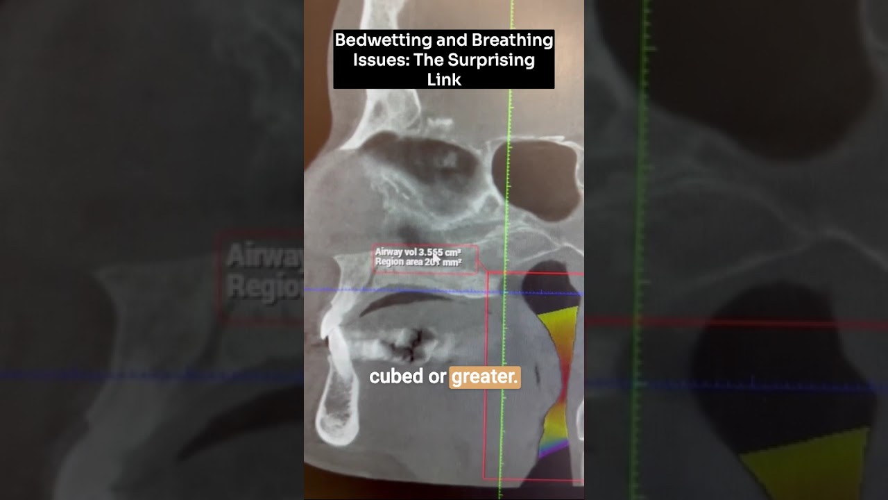 The Surprising Link Between Bedwetting and Breathing Issues 
