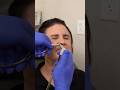 Nasopharyngoscopy Part 1 With Dr Neil Van Leeuwen Tanner Clinic Shorts Nasopharyngoscopy Part 1 With Dr Neil Van Leeuwen Tanner Clinic Shorts