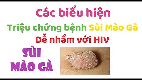 Hinh anh bệnh sùi mào gà là gì năm 2024