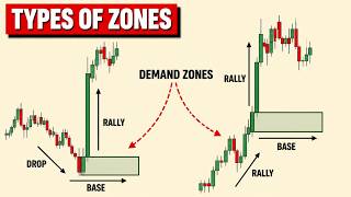 Supply Demand Zone Trading Ep. 2 - Types of Zones