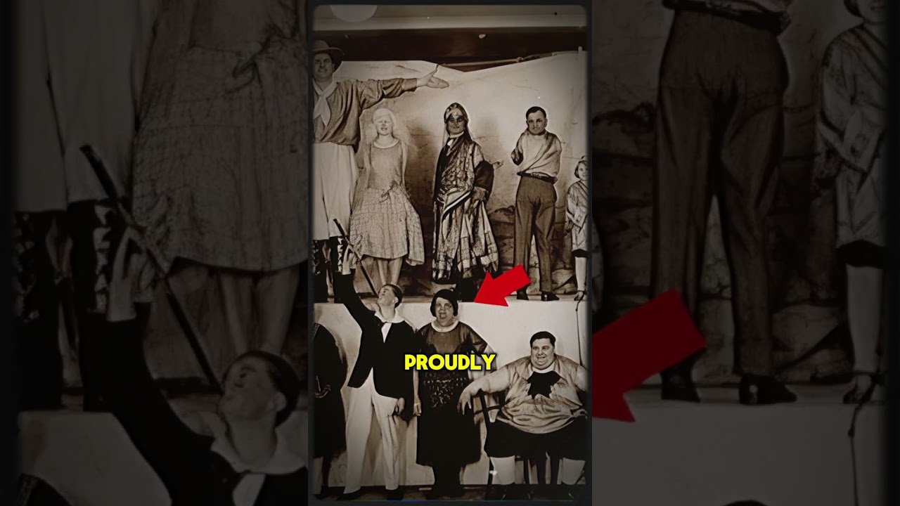 Her Face Changed… But Not Her Love | The 'Ugliest Woman' Mary Ann Bevan 