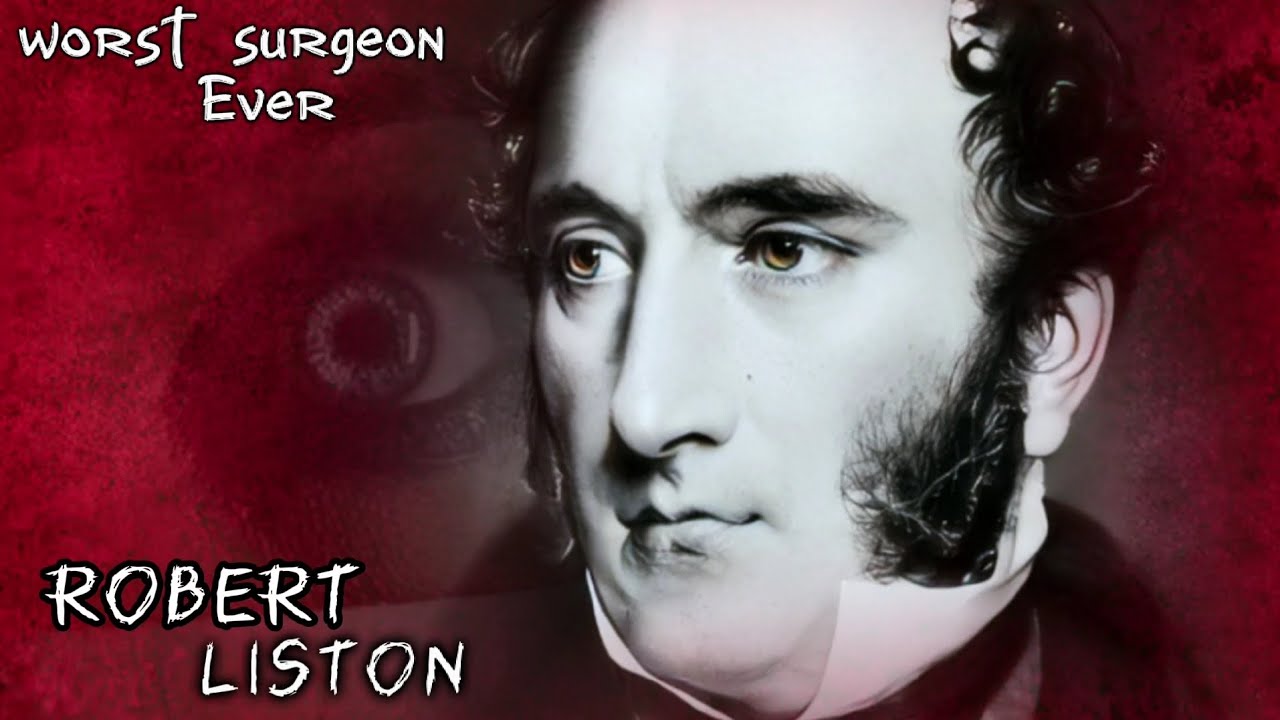 The Fastest Surgeon of the 19th Century:  long Story short of Robert Liston.
