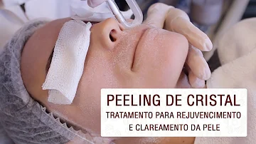 O que faz o peeling de cristal?