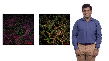 Mohit Jolly (Rice U.): Circulating tumor cell cluster: A model for cancer metastasis