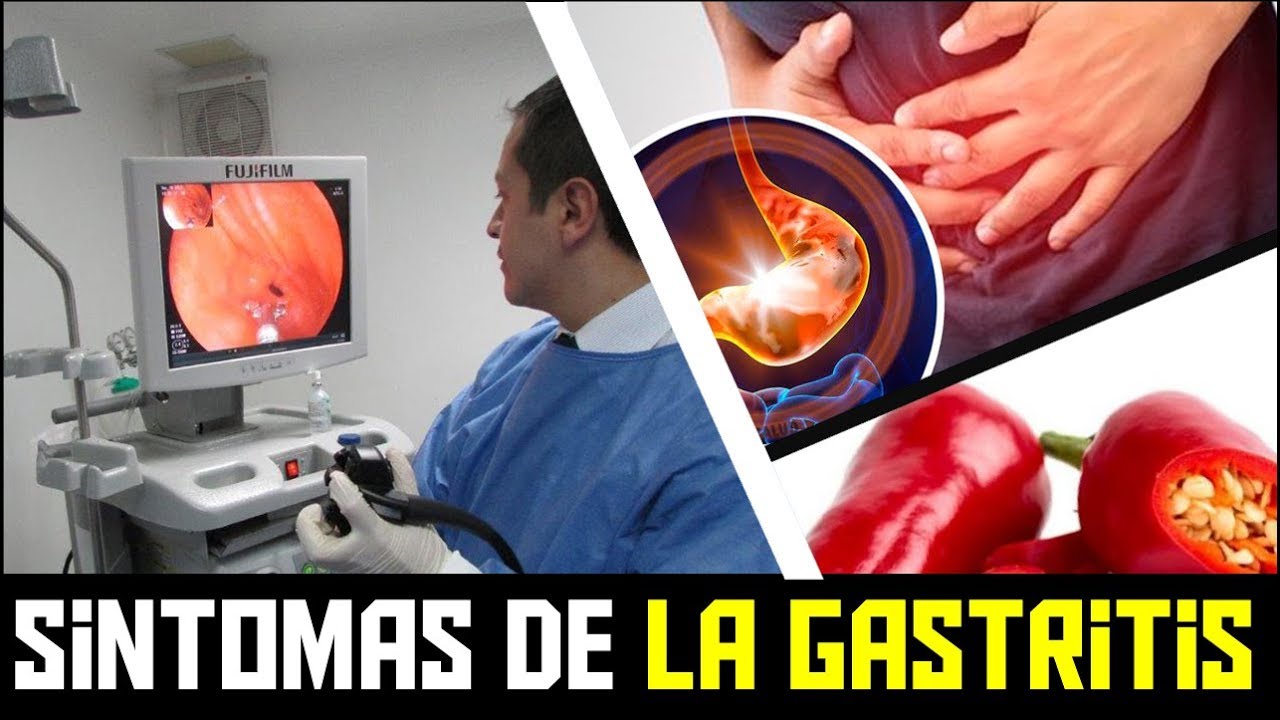 Que es la gastritis aguda sintomas