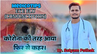 Eye Flu (Conjunctivitis) - आइ फ्लु से कैसे बचे corona flu viral trending conjuctivitis doctor