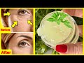 Parsley EYE Cream ! Remove Dark Circles, Wrinkles & Puffiness From Night to Morning ! Beauty DIY