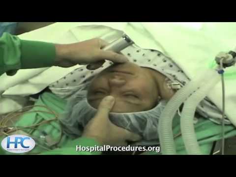Orotracheal Intubation Video procedures and processes