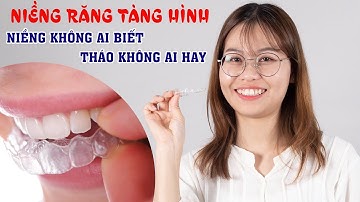 Chia sẻ trải nghiệm niềng răng trong suốt invisalign khay thứ 27 điều trị răng khấp khểnh