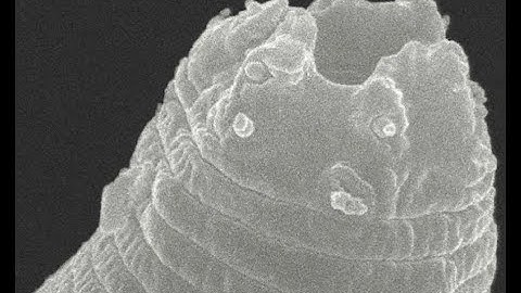 46,000 Year Old Worm Comes Back to Life