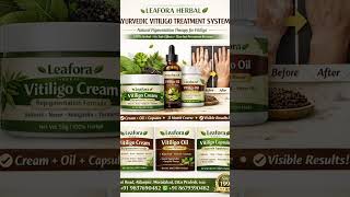 This is ayurvedic medicine vitiligo support no side effects pure herbal