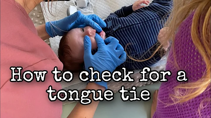 How to check for a tongue tie