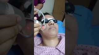 #skincare #fractionalco2laser #lasertreatment Contact us: 01987-381188, 01827-033209, 01718-105609