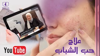 علاج حب الشباب دكتورة راندا موسى استشاري الجلدية والعلاج والتجميل بالليزر