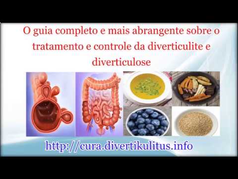 Dosagem de antibióticos para tratamento de diverticulite - YouTube