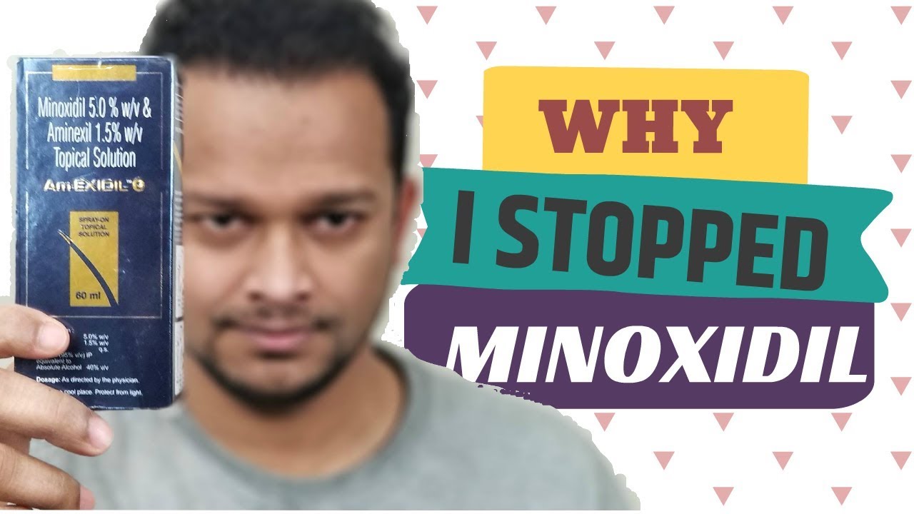 MINOXIDIL / ROGAINE SIDE MY 15 YEARS EXPERIENCE, MINOXIDIL BENEFITS, HOW USE - YouTube