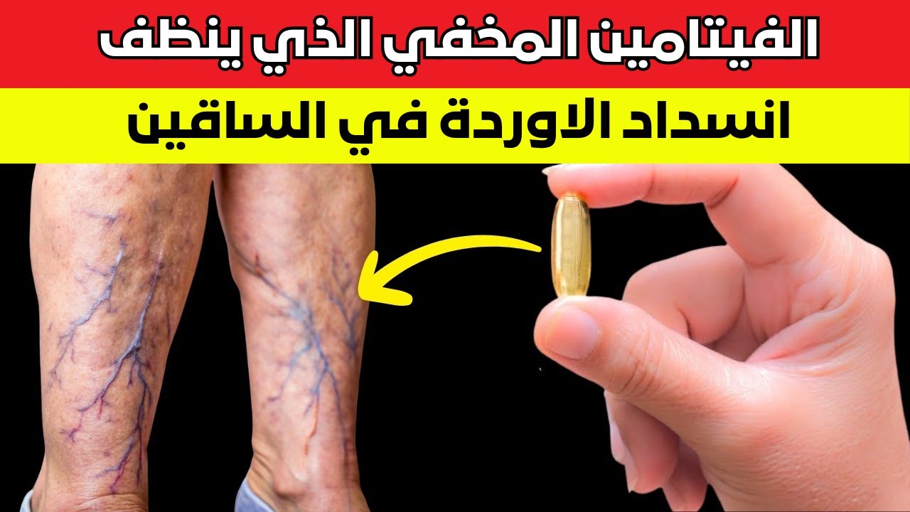 الفيتامين الأساسي لكبار السن للحفاظ على صحة الساقين ومنع الجلطات