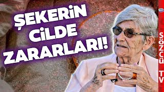 Şeker Ve Cilt Sağlığı Canan Karatay Şekerin Cilde Zararlarını Tek Tek Anlattı