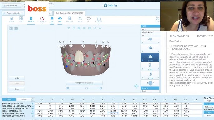 Invisalign Template