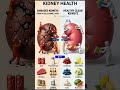 Kidney Health Guide 🧠 | Foods to Avoid & Best Foods for Clean Kidneys #heathyeating #shorts #viral