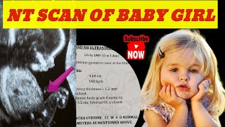 NT SCAN REPORT of BABY GIRL