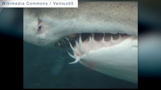 6 Year Old Boy Attacked By A Shark In Florida