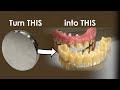 Make a Slim Full-Mouth Implant Prosthetics with Me