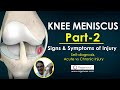 Knee Meniscus Part 2 - Signs & Symptoms of Injury, Self-diagnosis, Acute vs Chronic Injury