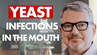 Yeast Infections in the Mouth | Small Bites