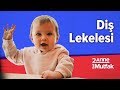 DiЕџ Lekelenmesi Neden Olur DiЕџ Lekelenmesi NasД L GeГ Er 4 I Bebek GeliЕџimi Ve Bebek SaДџlД ДџД DiЕџ Lekelenmesi Neden Olur DiЕџ Lekelenmesi NasД L GeГ Er 4 I Bebek GeliЕџimi Ve Bebek SaДџlД ДџД