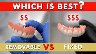 Thinking about Full Mouth Dental Implants? This is the first thing you need to think about