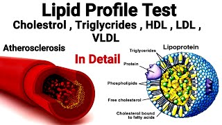 Lipid profile test ||  #Lipoproteins || #Cholestrol, #HDL , #LDL , #VLDL , #Triglycerides
