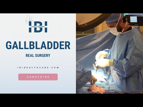 Real Surgery: Laparoscopic Cholecystectomy (Gallbladder Removal): 10/30/19