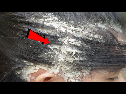 Satisfying Extremely Damaged